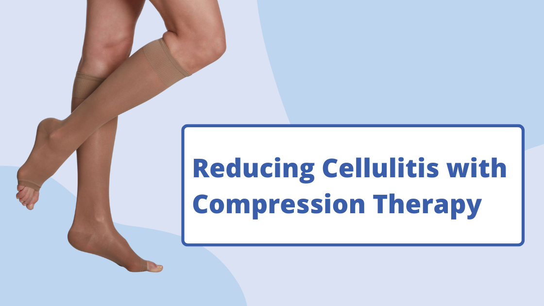 How Compression Therapy Can Reduce Reoccurrence of Cellulitis