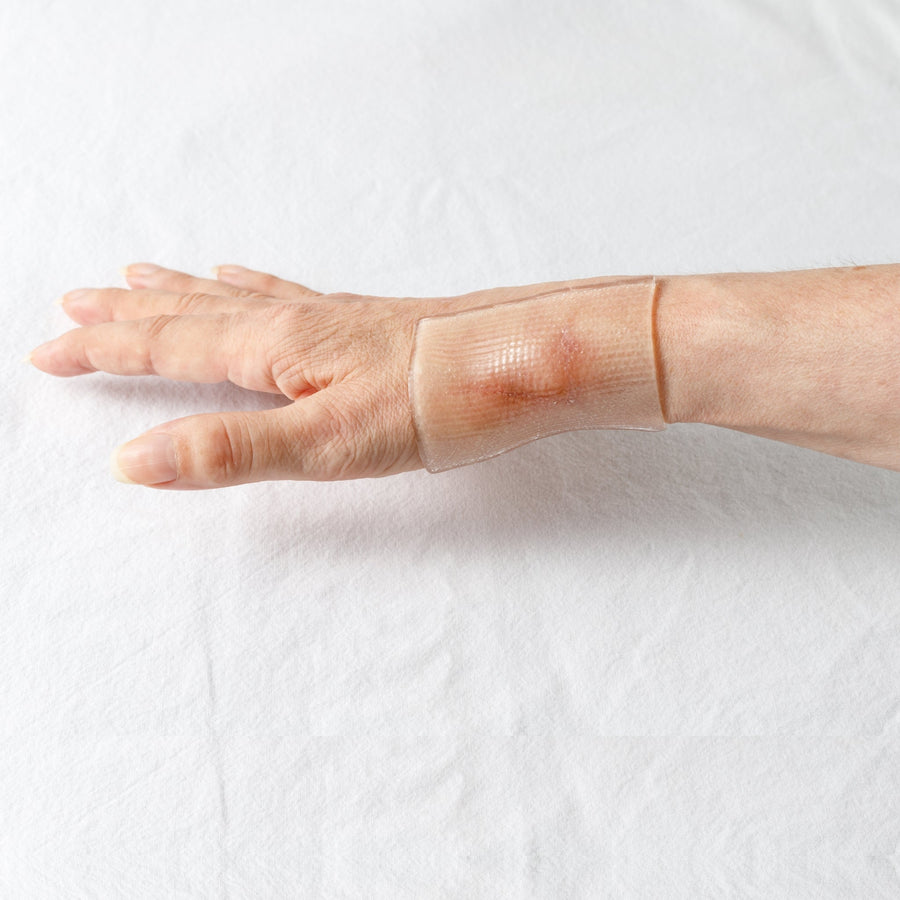 Scar Therapy
