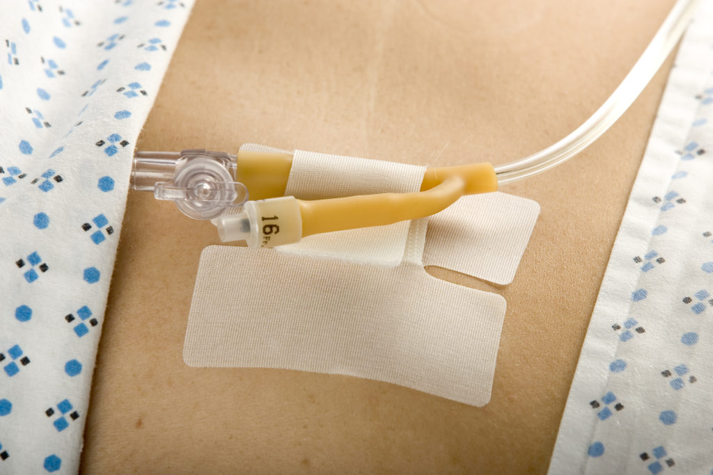 MC Johnson Cath-Secure Multi-Purpose Tube Holder Single Strap (1 Each)