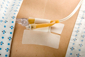 MC Johnson Cath-Secure Multi-Purpose Tube Holder Single Strap (1 Each)